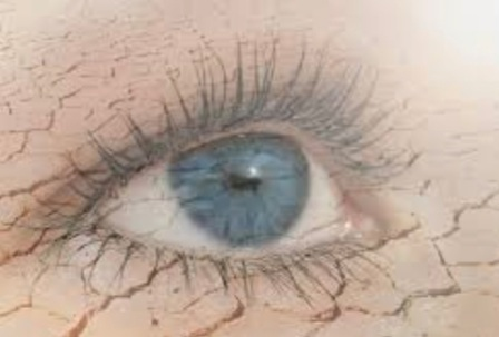 dry-eye
